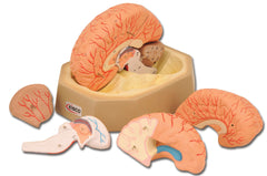 DISC-MODEL HUMAN BRAIN WITH ARTERIES 9 PTS