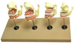 MODEL DENTITION MODEL - 4 STAGES