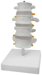 MODEL 4 LUMBAR VERTEBRAE