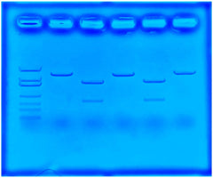 USING CRISPR TO TREAT CYSTIC FIBROSIS