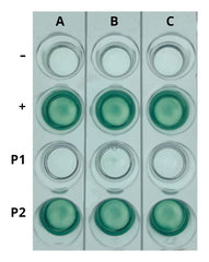 AIDS KIT I SIMULATION OF HIV DETECTION BY ELISA