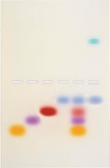 PRINCIPLES AND PRACTICE OF AGAROSE GEL ELECTROPHORESIS