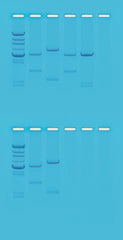 KIT DNA FINGERPRINTING USING RESTRICTION ENZYMES
