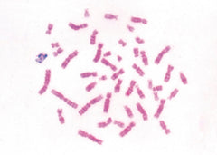 SLIDE MICROSCOPE BACTERIA INTRO SET/6