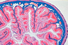 SLIDE SET HUHI2 HUMAN SET/12