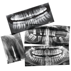 Xray-Teeth Chrt-Gde