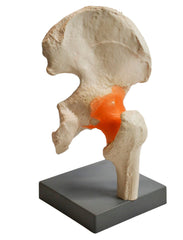 MODEL HUMAN HIP JOINT
