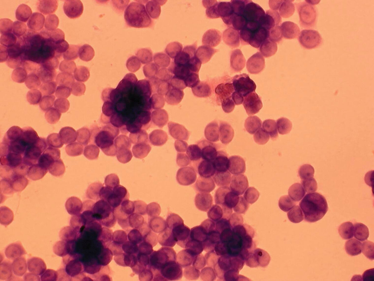 KIT MORPHOLOGY OF CANCER CELLS