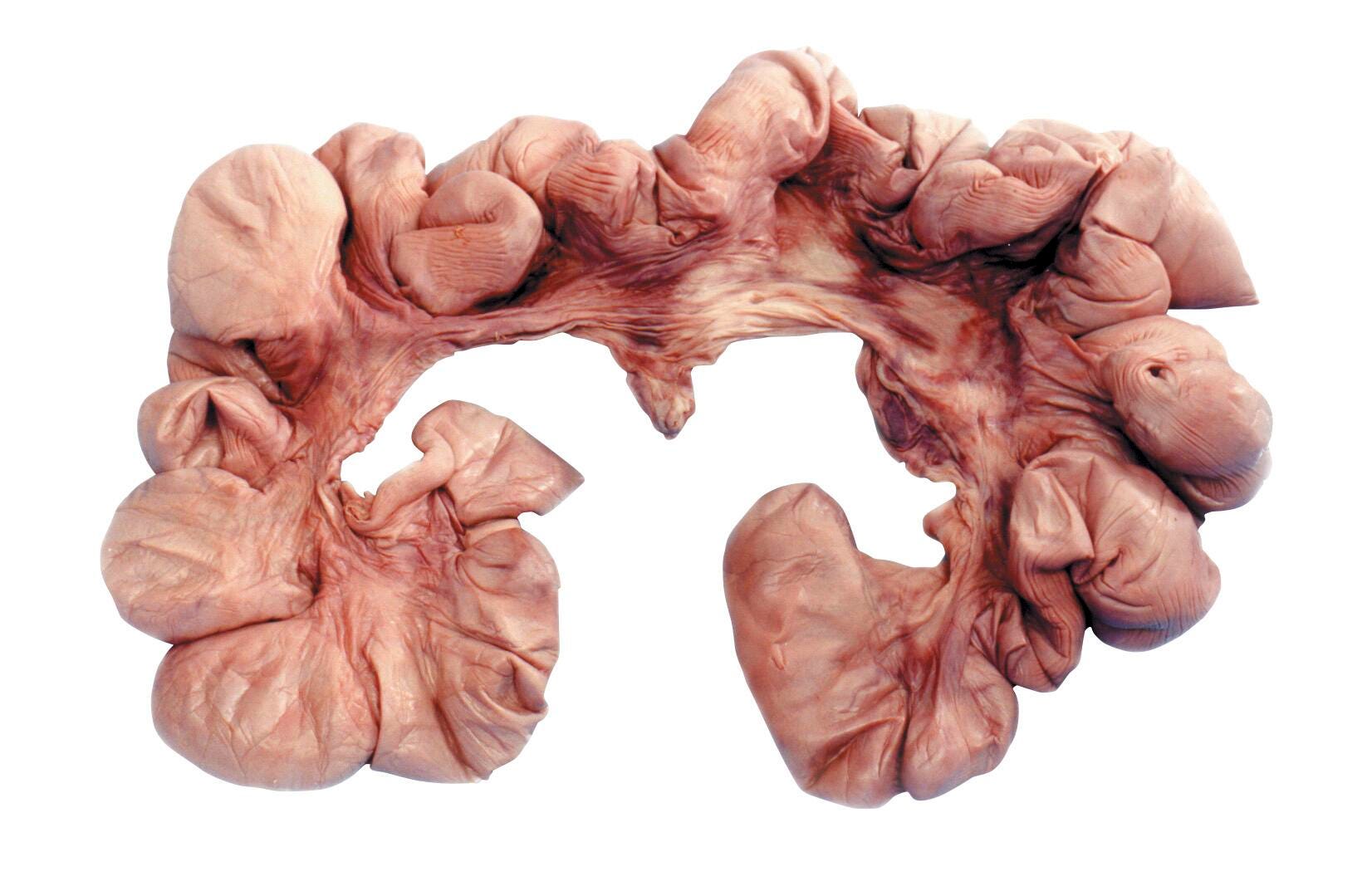 PIG UTERUS W/ EMBRYO PLAIN VAC EA