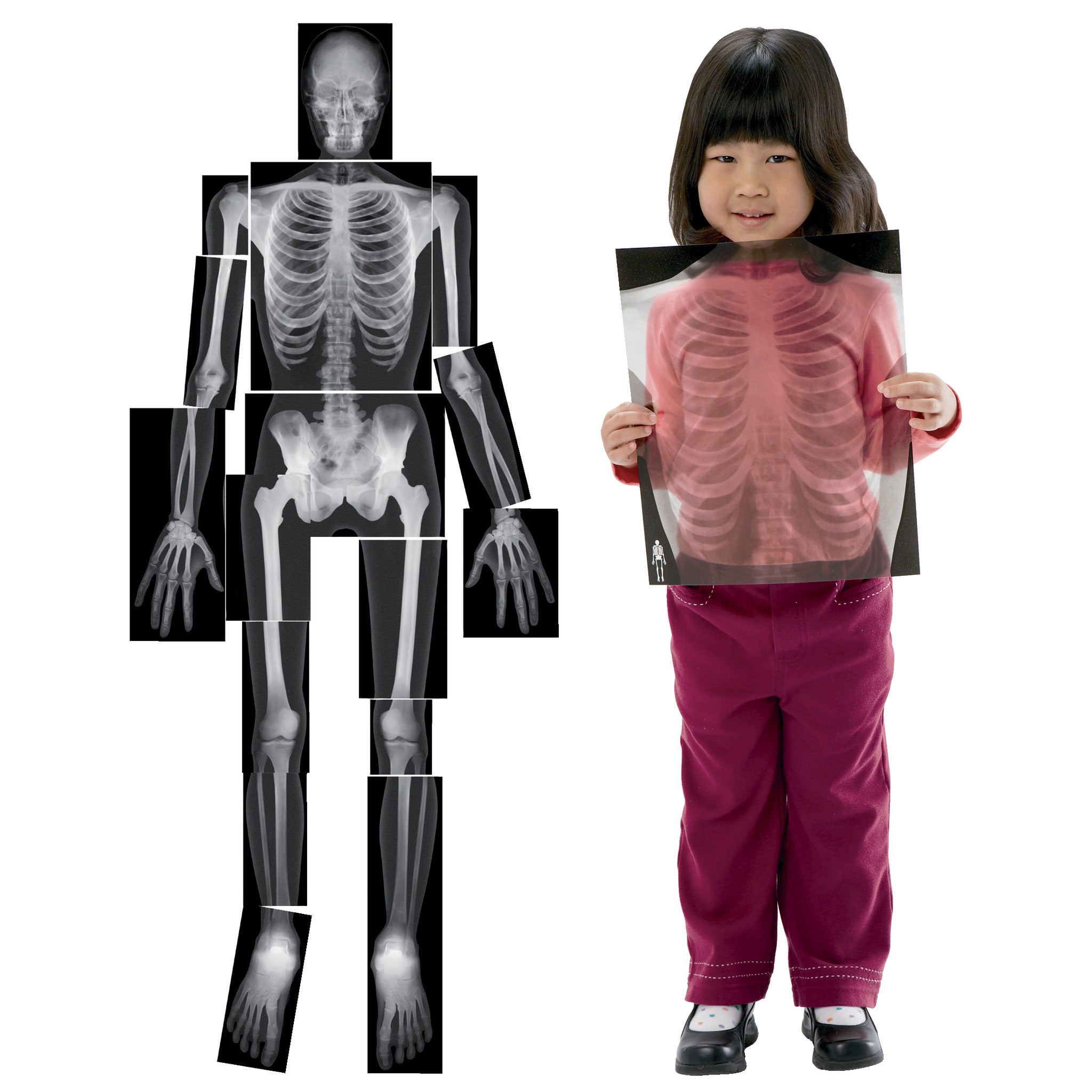 X-Rays Human True To Life Pk