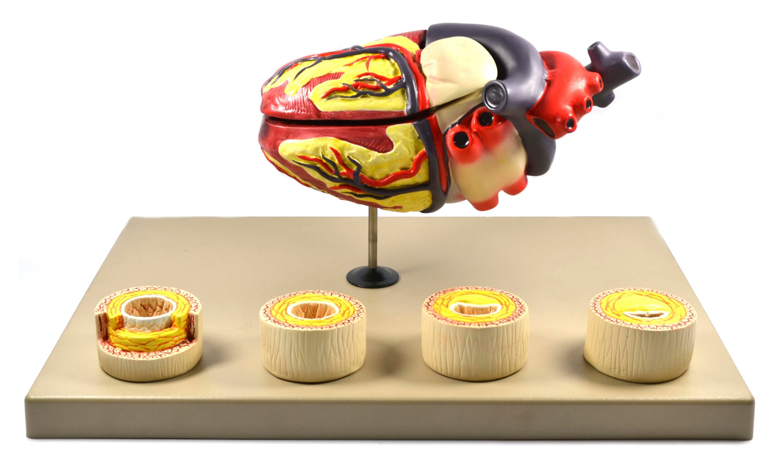MODEL PATHOLOGY HEART CONDITIONS
