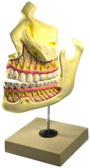 MODEL UPPER AND LOWER JAW