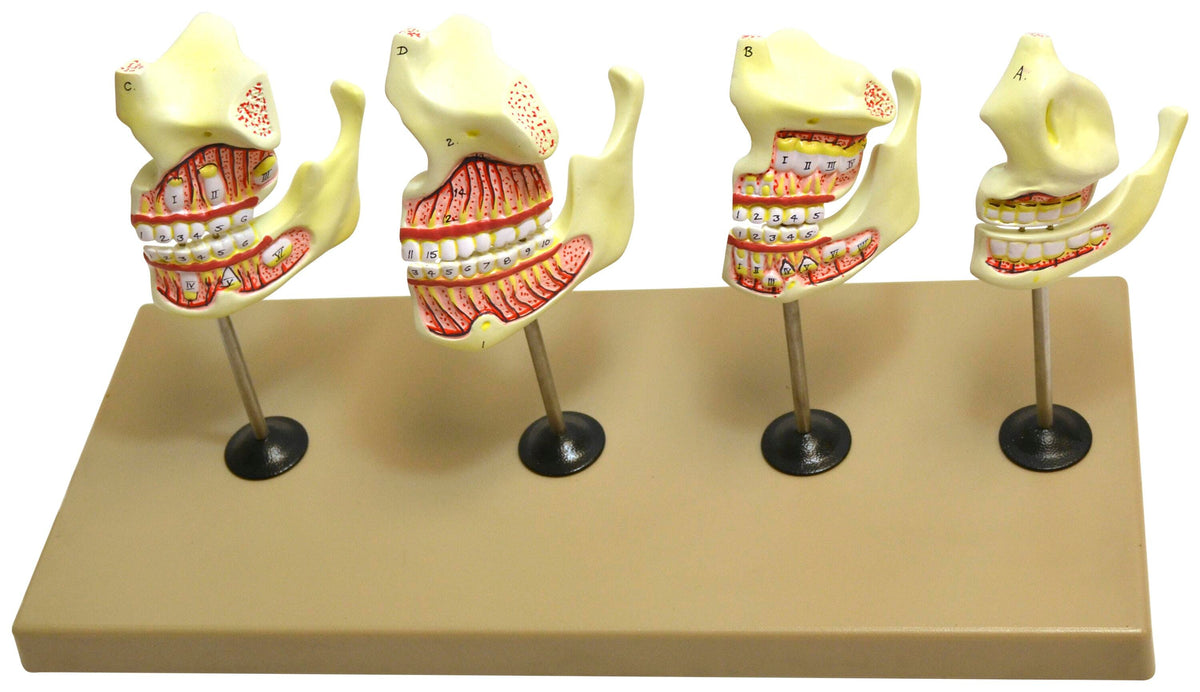 MODEL DENTITION MODEL - 4 STAGES