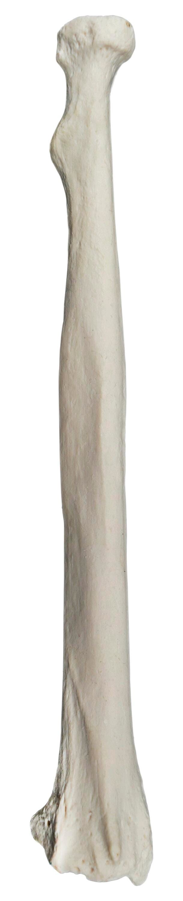 MODEL RIGHT RADIUS BONE