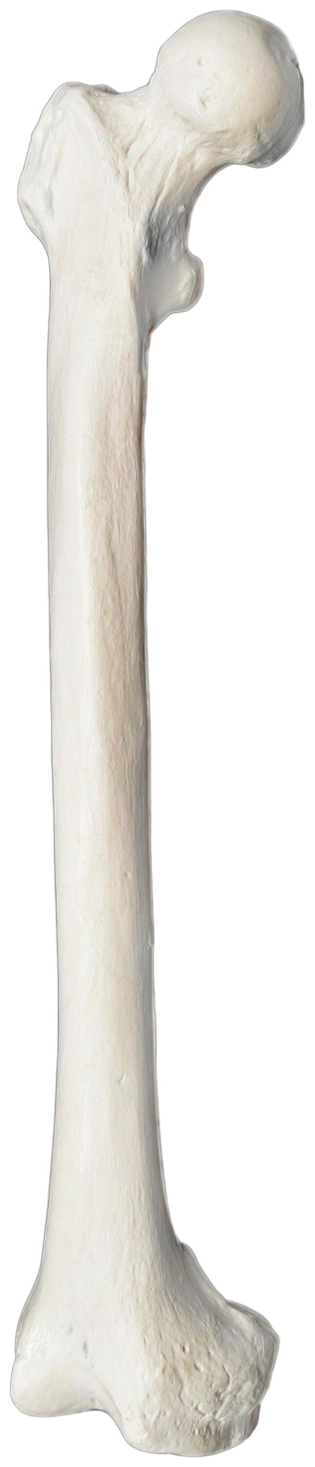 MODEL RIGHT FIBULA BONE