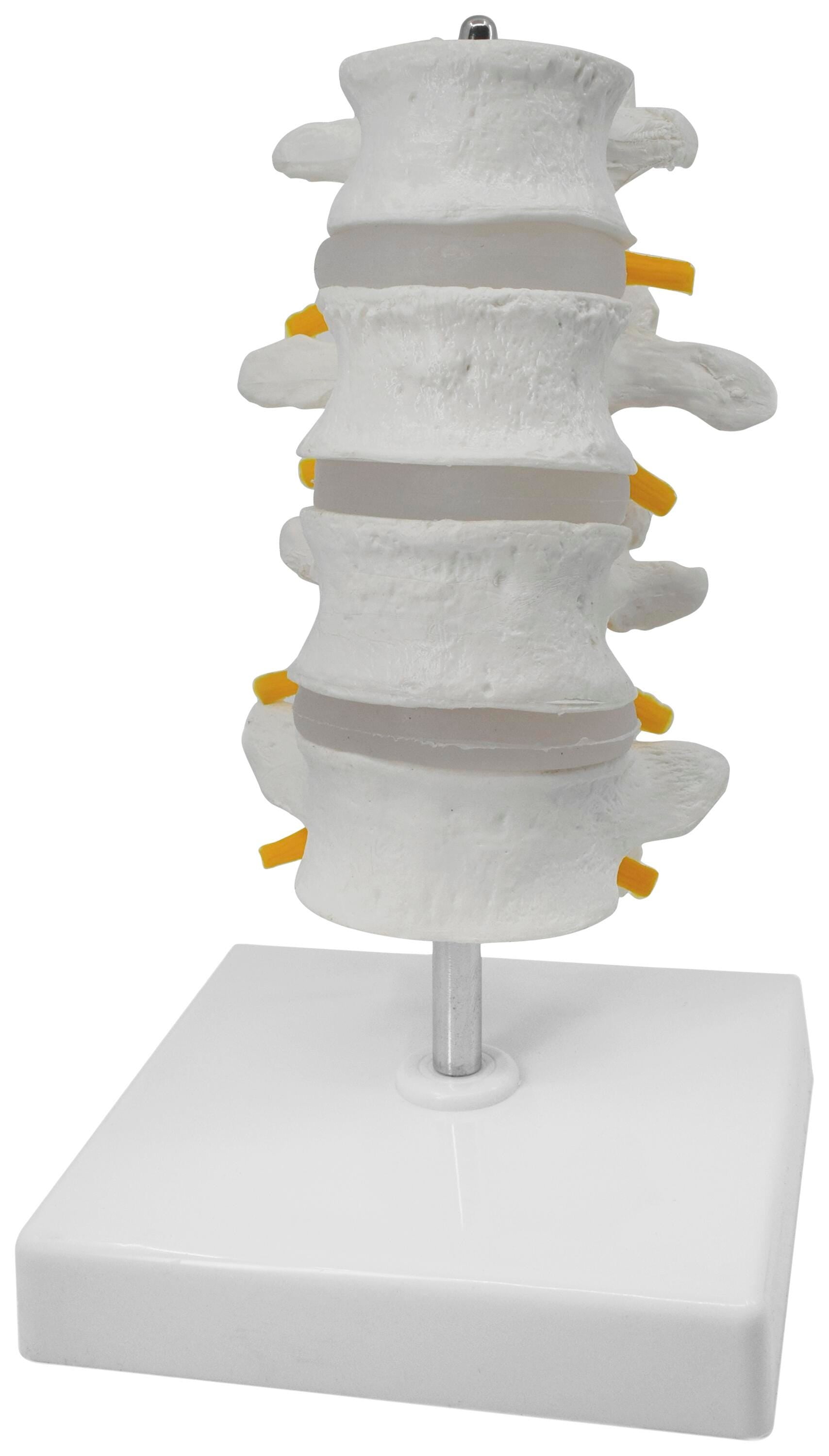 MODEL 4 LUMBAR VERTEBRAE