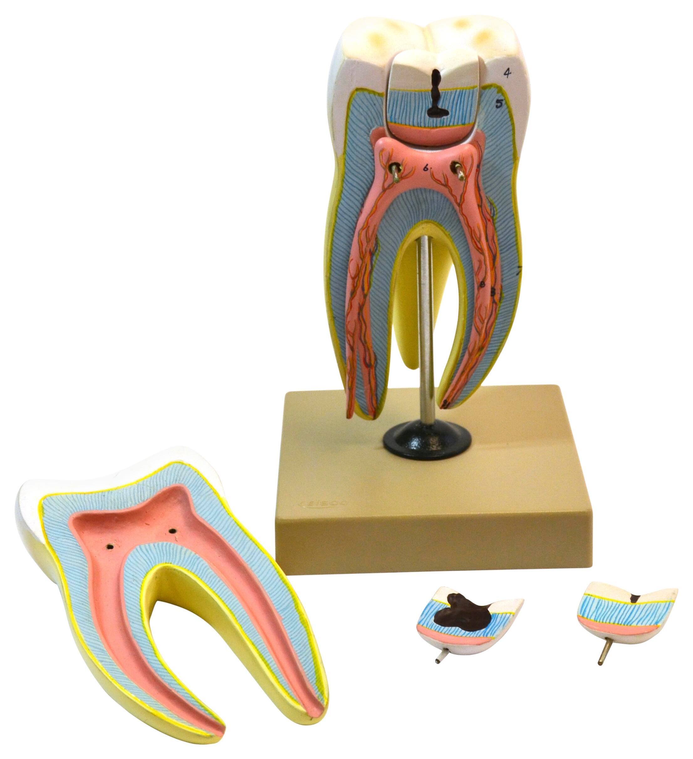 MODEL HUMAN UPPER TRIPLE ROOT MOLAR
