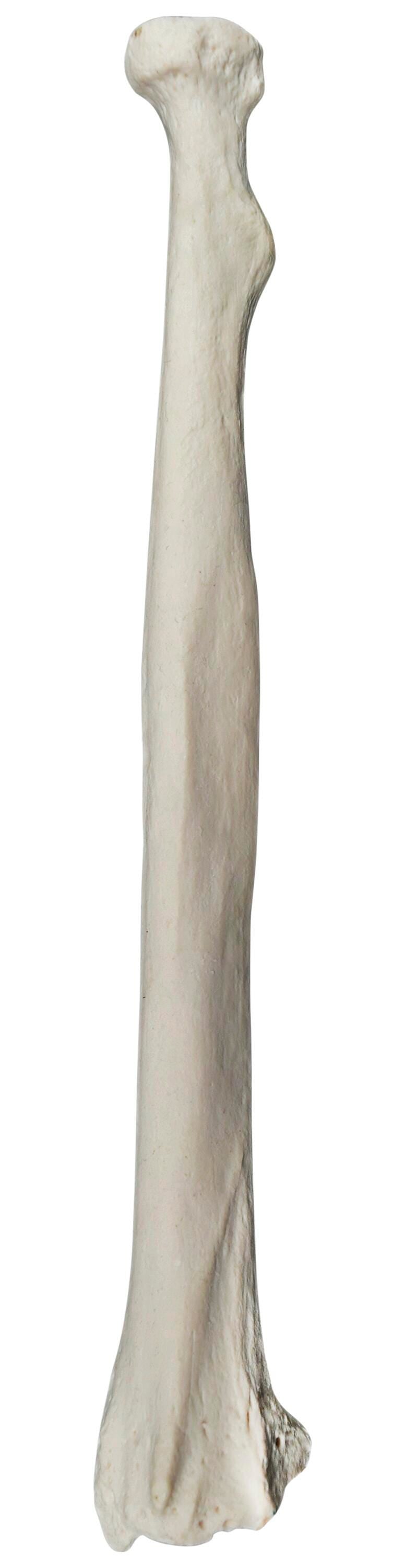 MODEL LEFT RADIUS BONE