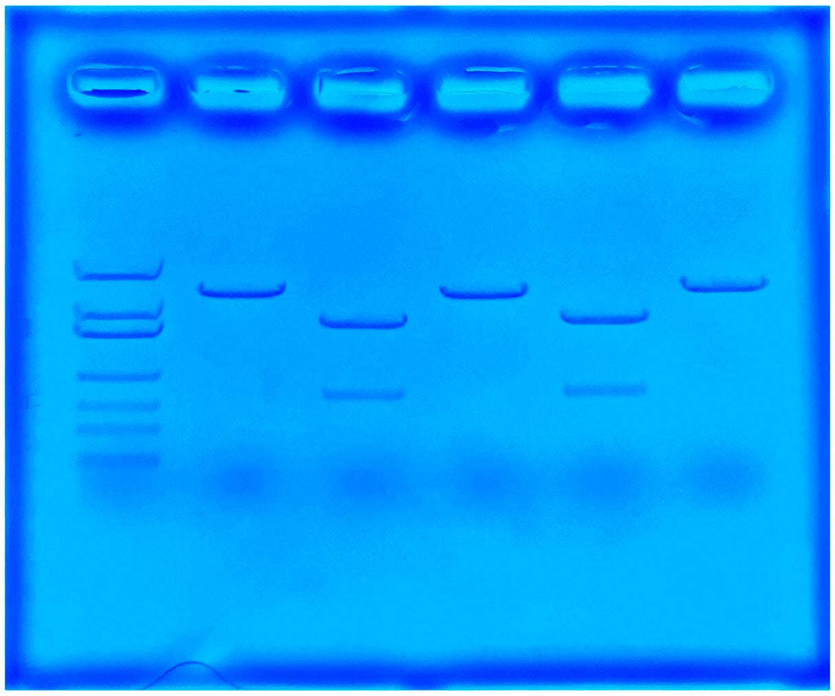 USING CRISPR TO TREAT CYSTIC FIBROSIS