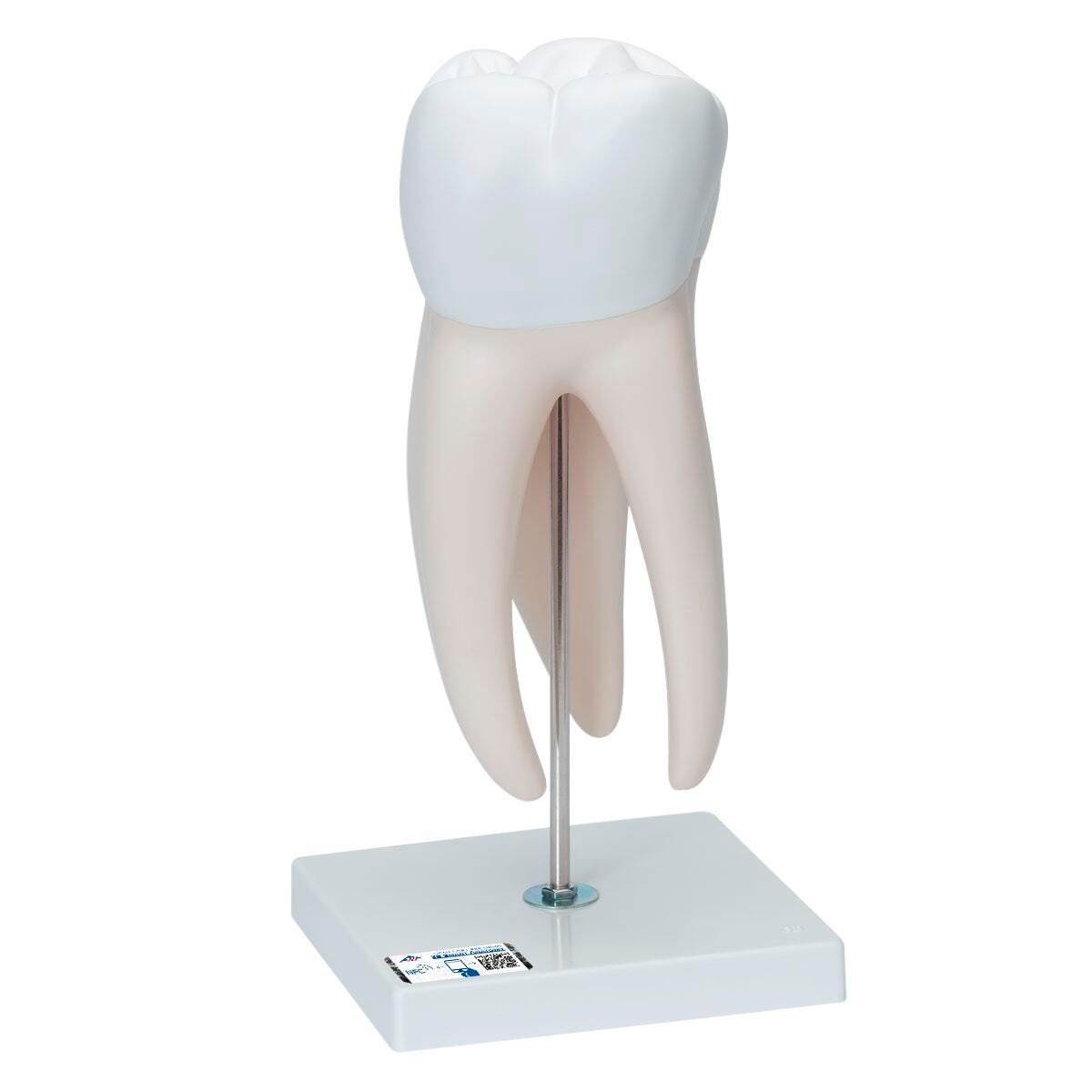 MODEL GIANT MOLAR W/ CAVITY