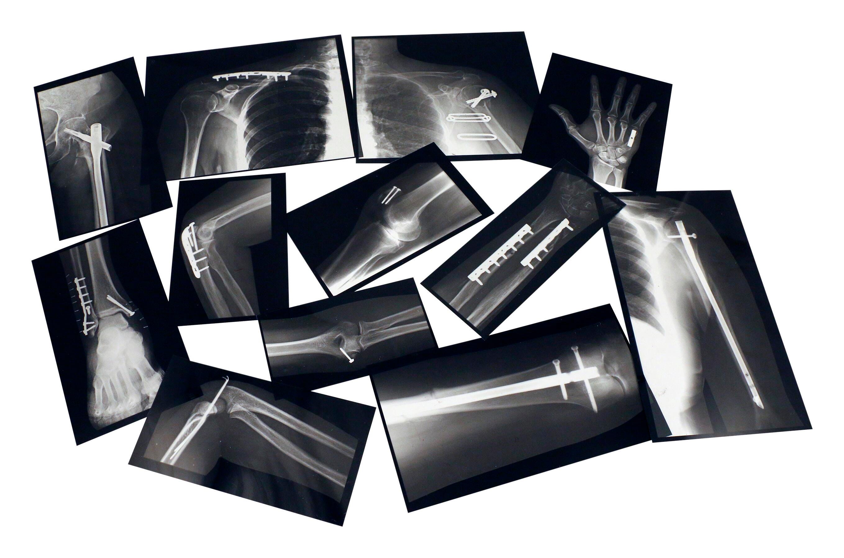ROYLCO FIXED BONES X-RAYS