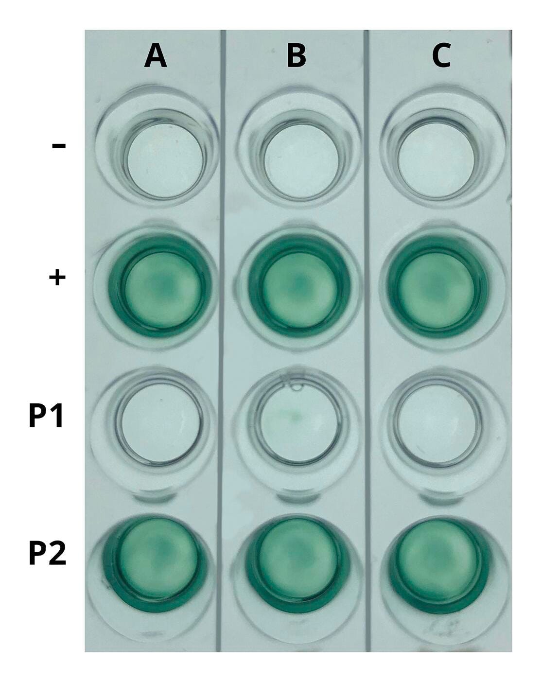 AIDS KIT I SIMULATION OF HIV DETECTION BY ELISA