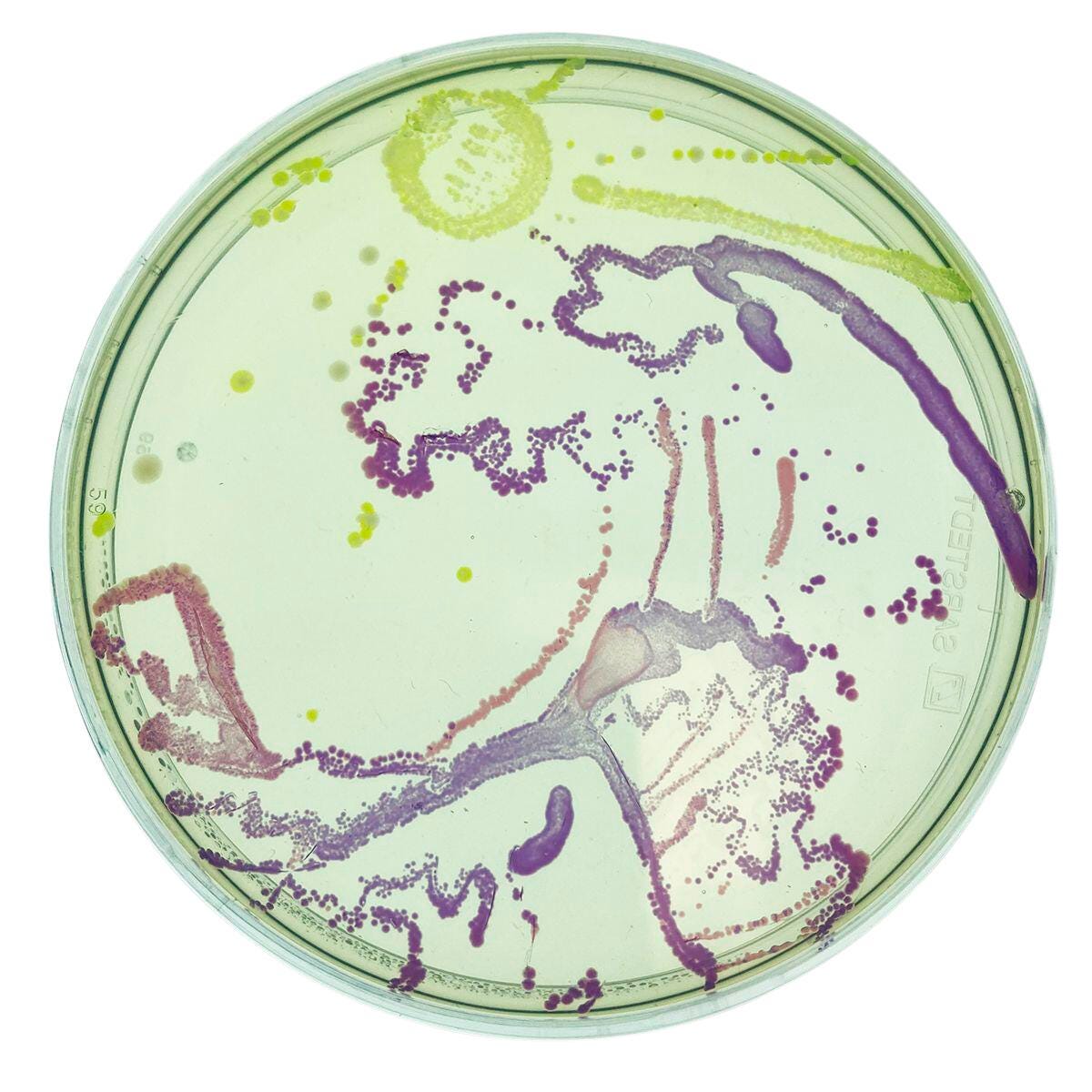 AGAR ART CREATING MASTERPIECES WITH MICROBES