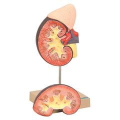 Model Kidney 2 Parts