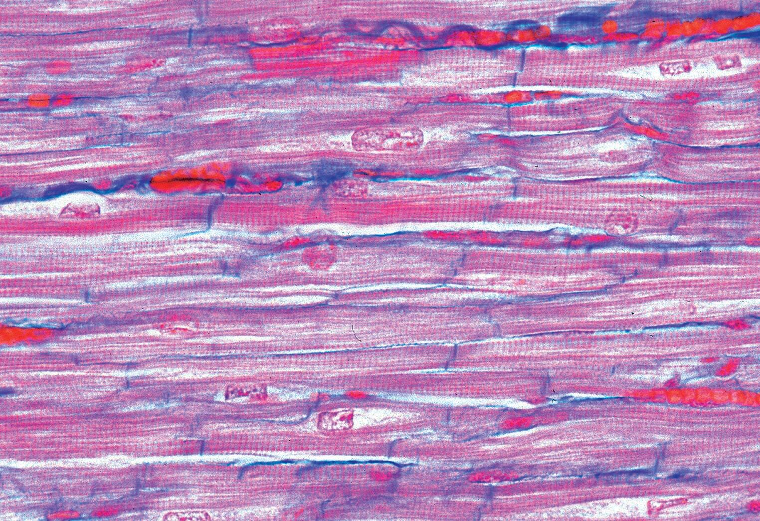 SLIDE HUMAN MUSCLE TYPES 3 ST