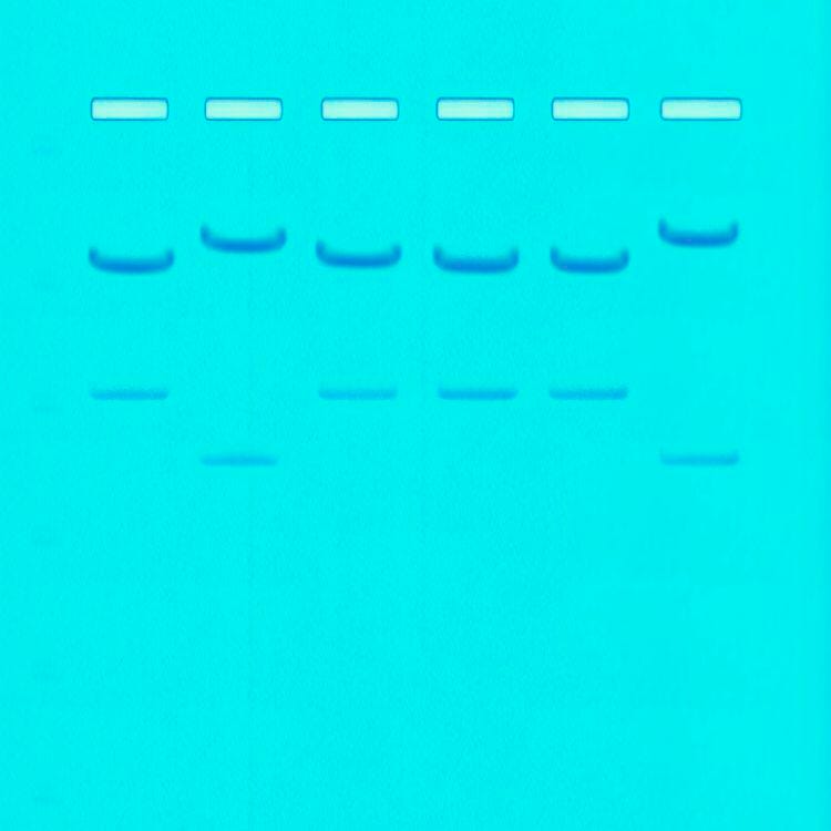 KIT DNA FINGERPRINTING RESTRICTION ENZYME PATTERNS