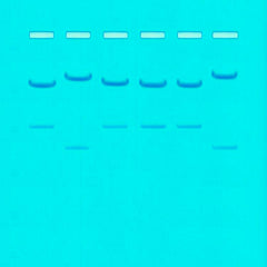 KIT DNA FINGERPRINTING RESTRICTION ENZYME PATTERNS