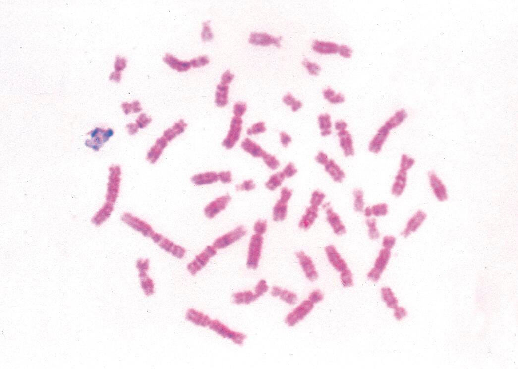 SLIDE MICROSCOPE BACTERIA STAND SET/25