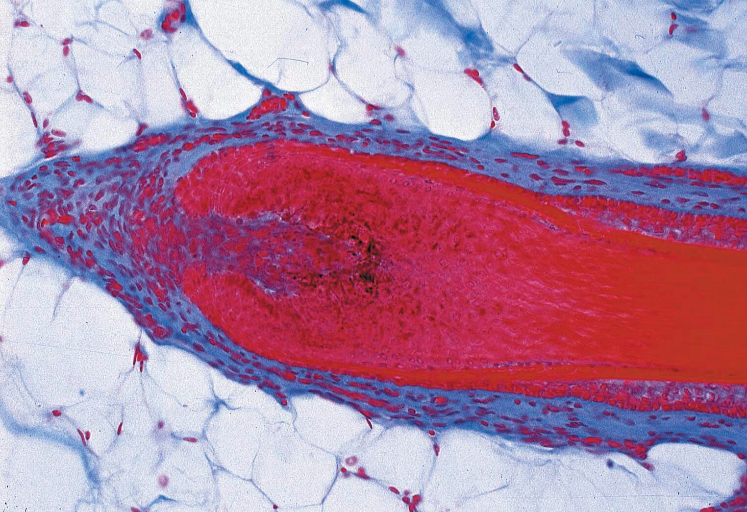 SLIDE MICROSCOPE HUMAN HAIR INTRO SET/6