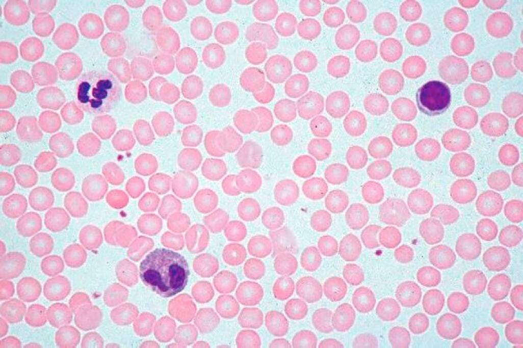 SLIDE SET HUHI1 HUMAN SET/25