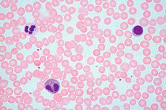 SLIDE SET HUHI1 HUMAN SET/25