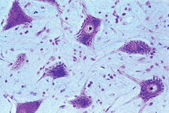 SLIDE SET HUHI3 HUMAN SET/6