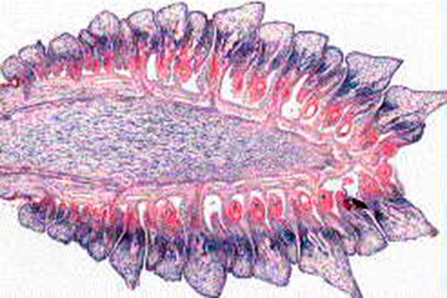 SLIDE SET NORMAL HUMAN SET/40