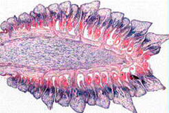 SLIDE SET NORMAL HUMAN SET/40