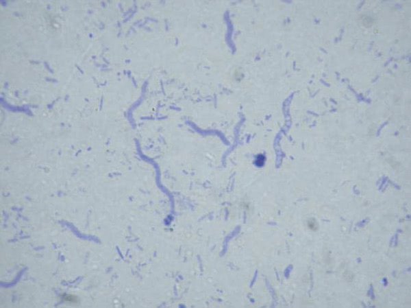 Bacteria Slides - Set of 12