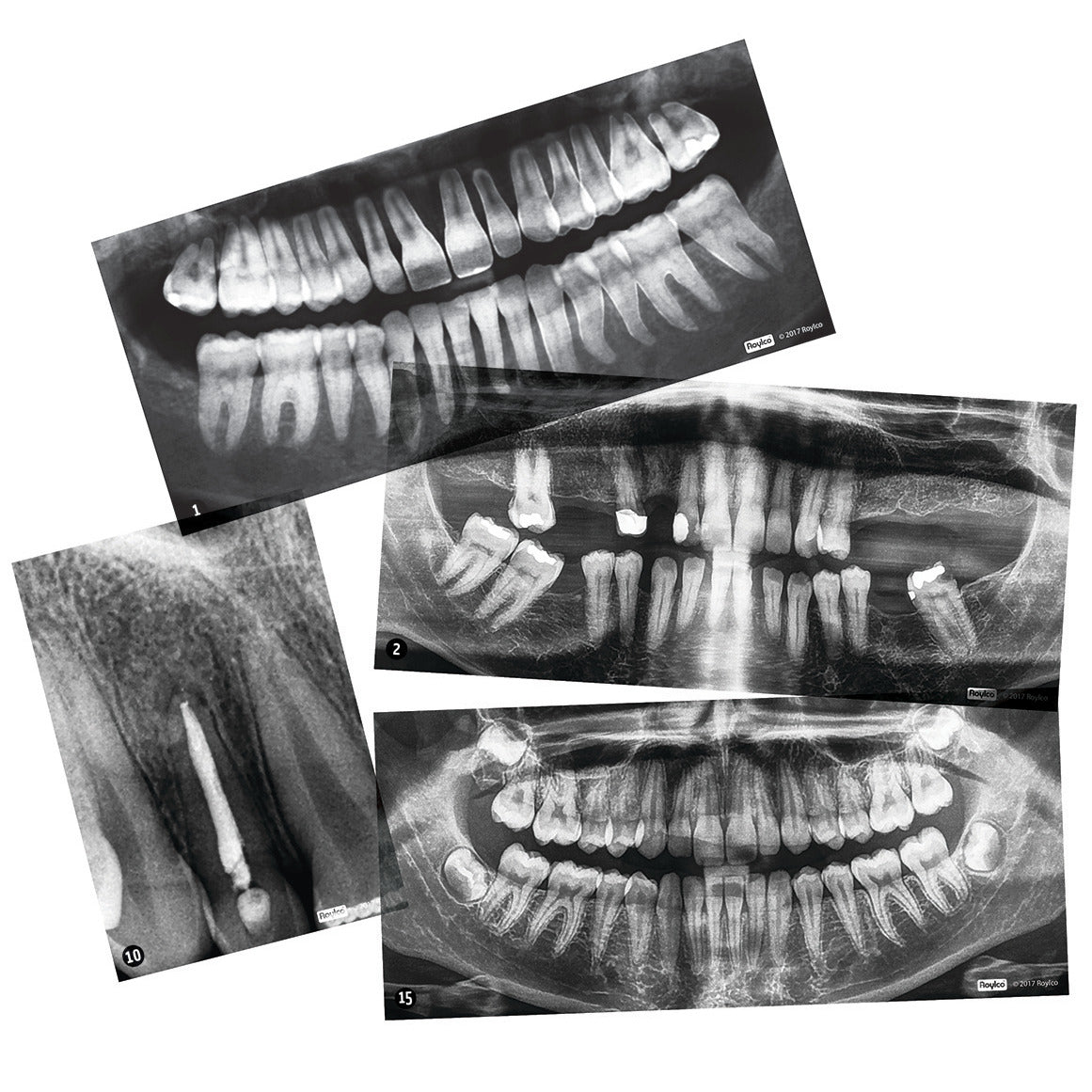 Xray-Teeth Chrt-Gde