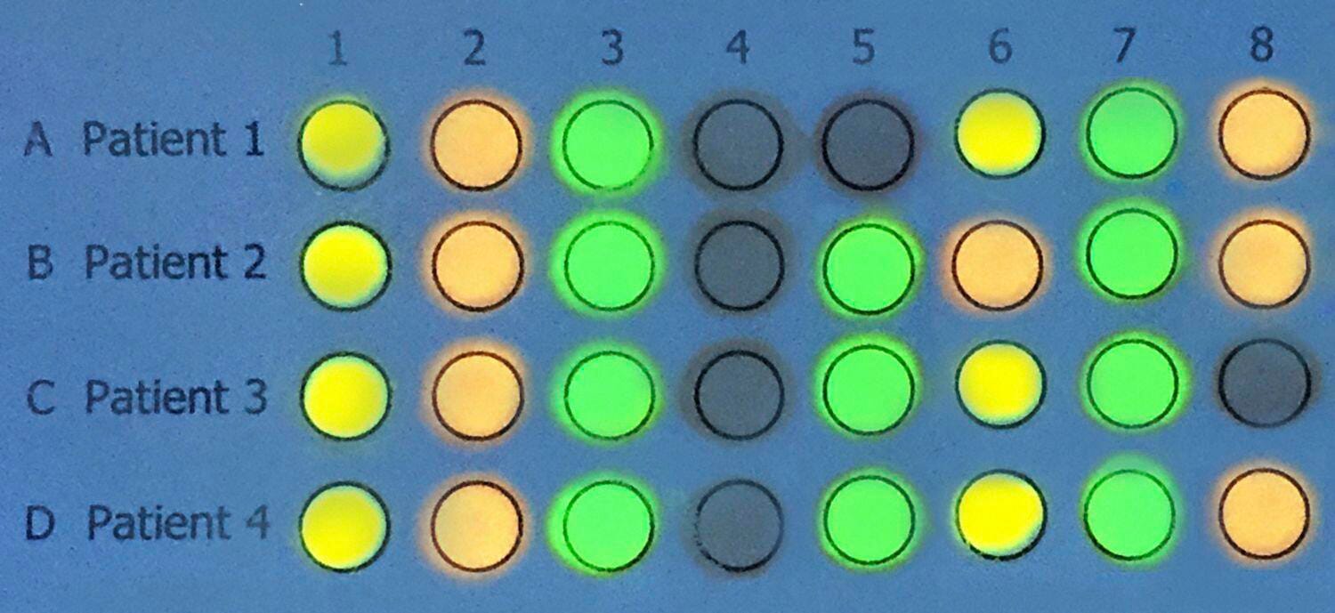DNA RNA MICROARRAYS